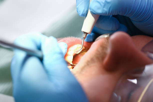 Best Weekend Emergency Dentist in Central Falls, RI