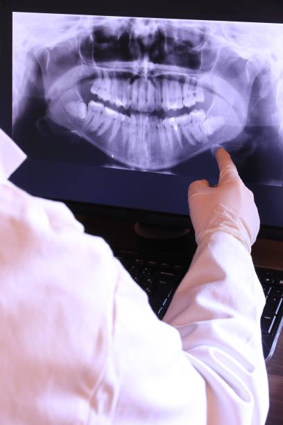 Best Emergency Broken Tooth Repair in Central Falls, RI