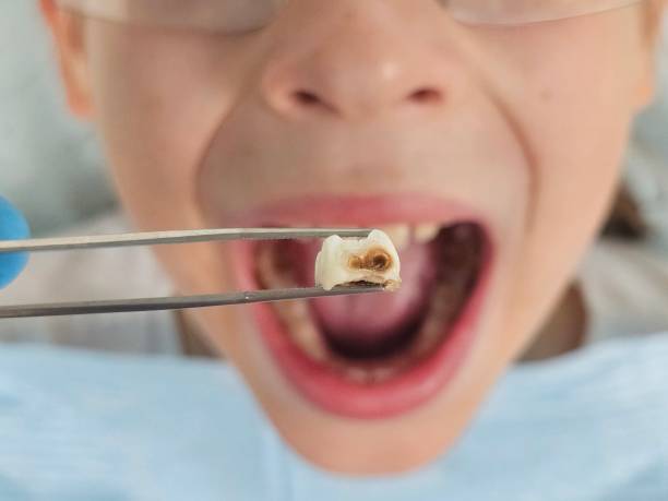 Best Walk-In Emergency Dentist in Central Falls, RI