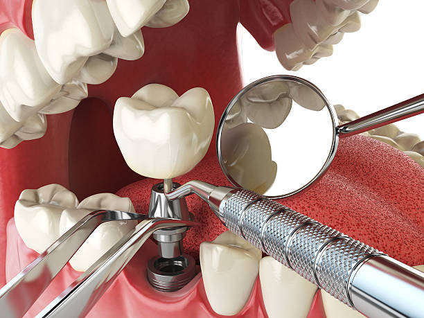 Best After-Hours Emergency Dentist in Central Falls, RI