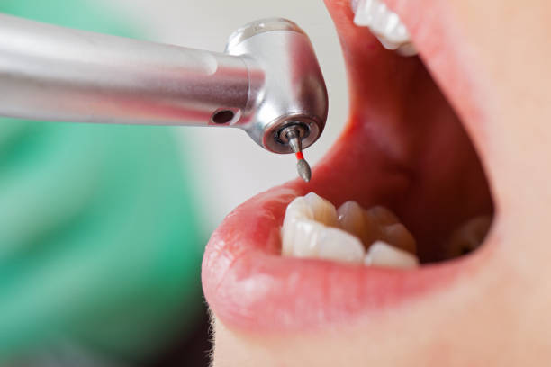 Best After-Hours Emergency Dentist in Central Falls, RI